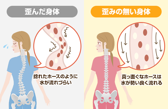 歪んだ身体の状態と歪みのない身体の状態の図