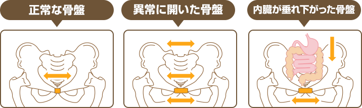 そもそも坐骨神経痛痛とはどういう症状なのか