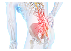 腰痛が他で改善しない理由 
