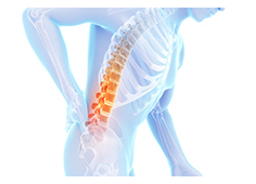 坐骨神経痛の本当の原因は？ 